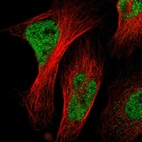 Immunofluorescent staining of human cell line U-2 OS shows localization to nucleoplasm.