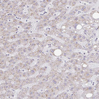 Immunohistochemical staining of human liver shows negative positivity in cytoplasm granular in hepatocytes.