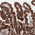 Immunohistochemical staining of human duodenum shows strong cytoplasmic positivity in glandular cells.