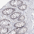 Immunohistochemical staining of human colon shows strong positivity in nucleoli in glandular cells.