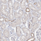 Immunohistochemical staining of human kidney shows strong positivity in nucleoli in cells in tubules.