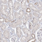 Immunohistochemical staining of human kidney shows strong positivity in nucleoli in cells in tubules.