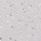 Immunohistochemical staining of human cerebral cortex shows strong positivity in nucleoli in neurons.