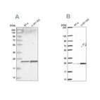 Western blot analysis using Anti-NOP16 antibody HPA036506 (A) shows similar pattern to independent antibody HPA058147 (B).