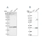 Western blot analysis using Anti-NOP16 antibody HPA036506 (A) shows similar pattern to independent antibody HPA058147 (B).