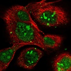 Immunofluorescent staining of human cell line A-431 shows localization to nucleus, nucleoli & vesicles.