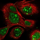 Immunofluorescent staining of human cell line A-431 shows localization to nucleus, nucleoli & vesicles.