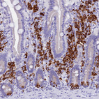 Immunohistochemical staining of human duodenum shows strong cytoplasmic positivity in lymphoid cells.