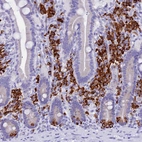 Immunohistochemical staining of human duodenum shows strong cytoplasmic positivity in lymphoid cells.