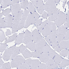Immunohistochemical staining of human skeletal muscle shows no positivity in myocytes as expected.