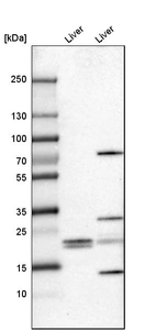 Western blot analysis in mouse liver tissue and rat liver tissue.