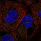 Immunofluorescent staining of human cell line A-431 shows localization to centrosome.