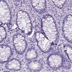 Immunohistochemical staining of human rectum shows no positivity in glandular cells as expected.
