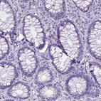 Immunohistochemical staining of human rectum shows no positivity in glandular cells as expected.