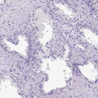 Immunohistochemical staining of human prostate shows no positivity in glandular cells as expected.