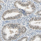 Immunohistochemical staining of human endometrium shows moderate positivity in nuclear membrane in glandular cells.