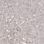 Immunohistochemical staining of human liver shows no positivity in hepatocytes as expected.