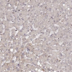 Immunohistochemical staining of human liver shows no positivity in hepatocytes as expected.