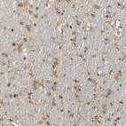 Immunohistochemical staining of human cerebral cortex shows moderate cytoplasmic and perinuclear positivity in glial cells.