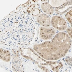 Immunohistochemical staining of human kidney shows moderate positivity in nuclear membrane in cells in tubules.