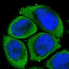 Immunofluorescent staining of human cell line A-431 shows localization to cytosol.