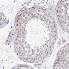 Immunohistochemical staining of human testis shows moderate cytoplasmic positivity in spermatogonia.