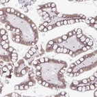 Immunohistochemical staining of human small intestine shows moderate cytoplasmic positivity in glandular cells.