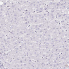 Immunohistochemical staining of human liver shows no positivity in hepatocytes as expected.