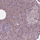 Immunohistochemical staining of human pancreas shows strong membranous positivity in exocrine glandular cells.