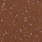 Immunohistochemical staining of human cerebral cortex shows strong cytoplasmic positivity in neuropil.