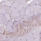 Immunohistochemical staining of human skeletal muscle shows no positivity in myocytes as expected.