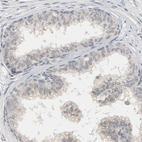 Immunohistochemical staining of human prostate shows no positivity in glandular cells as expected.