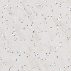 Immunohistochemical staining of human skeletal muscle shows no positivity in myocytes as expected.