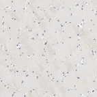 Immunohistochemical staining of human skeletal muscle shows no positivity in myocytes as expected.