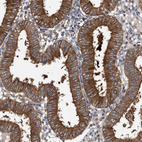 Immunohistochemical staining of human endometrium shows strong cytoplasmic positivity in glandular cells.