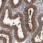 Immunohistochemical staining of human endometrium shows strong cytoplasmic positivity in glandular cells.