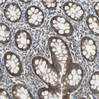 Immunohistochemical staining of human rectum shows strong cytoplasmic positivity in glandular cells.
