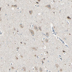 Immunohistochemical staining of human cerebral cortex shows moderate cytoplasmic positivity in neurons.
