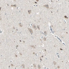 Immunohistochemical staining of human cerebral cortex shows moderate cytoplasmic positivity in neurons.