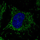 Anti-CS Antibody