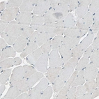 Immunohistochemical staining of human skeletal muscle shows no cytoplasmic positivity in myocytes as expected.