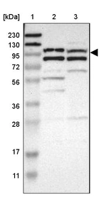 Lane 1: Marker [kDa] 230, 130, 95, 72, 56, 36, 28, 17, 11_br/_Lane 2: Human cell line RT-4_br/_Lane 3: Human cell line U-251MG sp