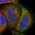 Immunofluorescent staining of human cell line A-431 shows localization to plasma membrane & cytosol.