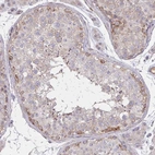 Immunohistochemical staining of human testis shows moderate membranous positivity in spermatogonia.