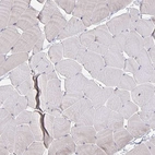 Immunohistochemical staining of human skeletal muscle shows no membranous positivity in myocytes as expected.