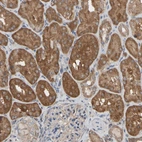 Immunohistochemical staining of human kidney shows strong cytoplasmic positivity in cells in tubules.