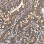 Immunohistochemical staining of human duodenum shows strong cytoplasmic positivity in glandular cells.