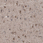 Immunohistochemical staining of human cerebral cortex shows strong cytoplasmic positivity in glial cells.