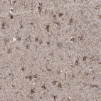 Immunohistochemical staining of human cerebral cortex shows strong cytoplasmic positivity in glial cells.