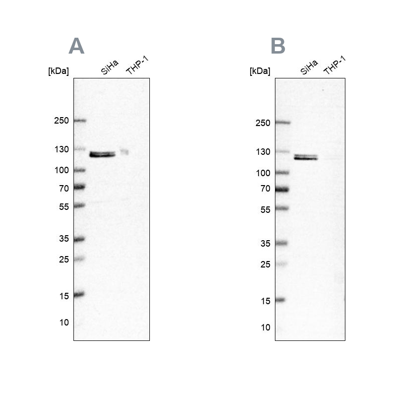 Anti-UBA1 Antibody